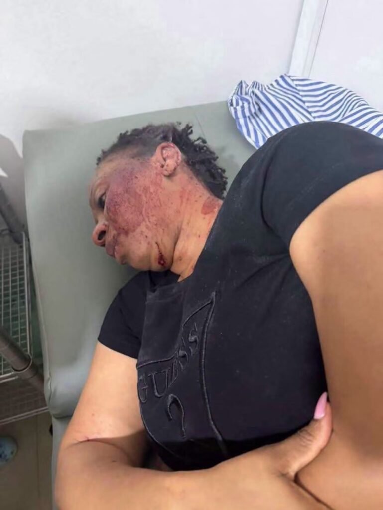 Former MP Adwoa Safo Shot At, Suffers Injury Former MP Adwoa Safo Shot At, Suffers Injury